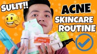 ACNE SKINCARE ROUTINE | Lahat Sulit