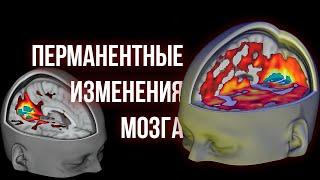 ПСИХОДЕЛИКИ ч.3 [Изменения в мозге и личности, применение в медицине]