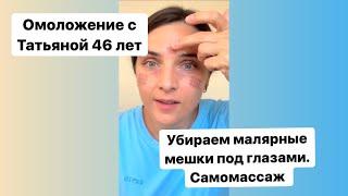 Самомассаж от малярных мешков