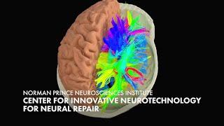 Introducing the Center for Innovative Neurotechnology for Neural Repair