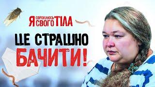 Личинки на нижнем белье – Я соромлюсь свого тіла | МЕДИЦИНА | ВРАЧИ | ЗДОРОВЬЕ
