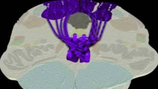 Neuroanatomy - The Dorsal Column-Medial Lemniscus Tract in 3D