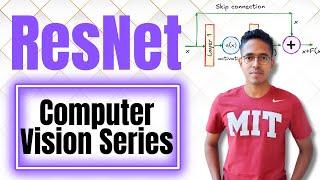 ResNet Explained - Vanishing Gradients, Skip Connections, and Code Implementation | Computer Vision