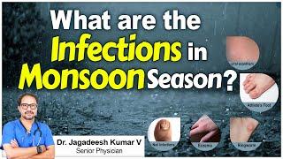 Hi9 | What are the Infections in Monsoon Season | Dr. Jagadeesh Kumar VSenior Physician