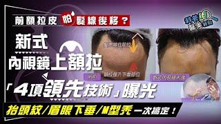 五爪內視鏡前額拉皮搞不定抬頭紋！眉眼下垂不敢前額拉皮？新式內視鏡上額拉「4項領先技術」曝光 同步挽救M型禿危機  科普醫美新知 323-20230714