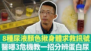 【健康療天室】8種尿液顏色揪身體求救訊號　醫曝3危機教一招分辨蛋白尿｜中時新聞網