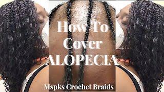 How To Cover Alopecia | Step By Step | Ms. Pk's Crochet Braids | Tutorial 4