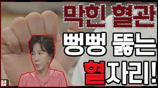 꽉 막힌 혈관 뻥뻥 뚫어주는 손바닥 혈자리는? MBN 200420 방송