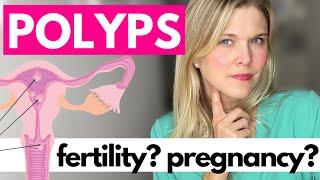 Uterine Polyps: Symptoms, Removal, and Impacts on Fertility, Pregnancy and TTC
