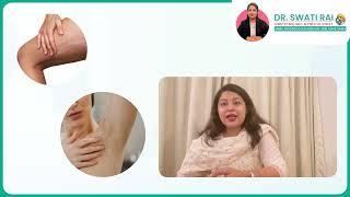 Symptoms of PCOS by Dr. Swati Rai