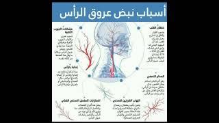 أسباب نبض عروقي الرأس