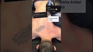 Before and after laser tattoo removal #lasertattooremoval #lasertattooremoval #beforeandafter