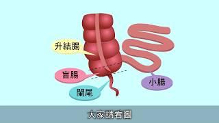 【醫師聊天室】為什麼闌尾會發炎？