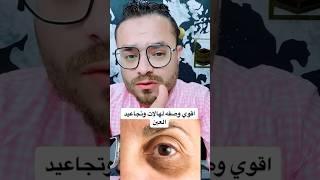 اقوي وصفه للهالات والخطوط تحت العين #الأمهات #السيدات #تجاعيد_الوجه #تجاعيد_العين #تجاعيد