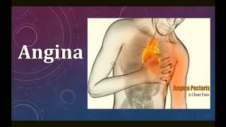 Angina NCLEX Memory Refresher for Nurses