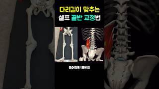 다리길이 맞춰지는 셀프 골반 교정법