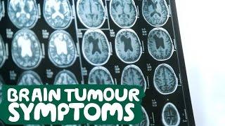 About Brain Tumour Symptoms - Macmillan Cancer Support