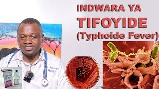 Indwara ya TIFOYIDE (Typhoid fever) uko yandura, uko bayipima n'imiti Iyivura