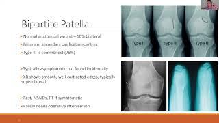 Fundamentals of Orthopaedics Session 10: Knee Trauma and Soft Tissue Injury