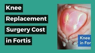 Knee Replacement Surgery  Cost in Fortis, Fortis Hospital Knee Replacement