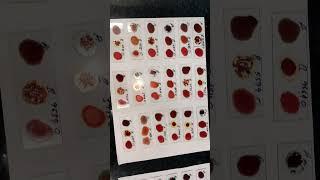 Blood Grouping test #smartphone #pathologylaboratory #musicremix #machine #remixsong #lab #reels