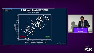 Pressure microcatheter guided PCI: optimise stent implantation and assess functional result