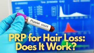 An In-Depth Review of PRP for Hair Loss