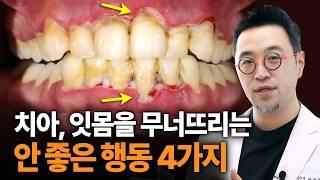 소리 없는 이빨도둑, 잇몸병의 원인이 되는 4가지 습관