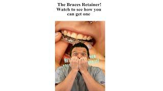 You've never seen a retainer like this    @bracesbysable@DrBrittanyIlene ​