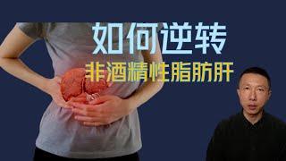 How to Treat and Reverse Non-Alcoholic Fatty Liver Disease? (Medication is Not the Key)