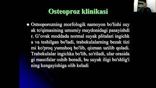 Остеопороз  Эпидемиологияси, давоси ва профилактикаси