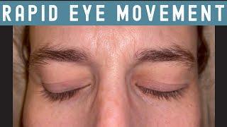 Rapid Eye Movement (REM) Sleep