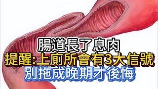 腸道長了息肉，提醒：上廁所會有3大信號，別拖成晚期才後悔