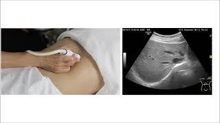 Abdominal Ultrasound Scanning Technique for the Beginner