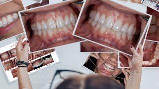 Dental Photography Basics - Standard Views and Photo Series Options for Your DENTAL Practice!