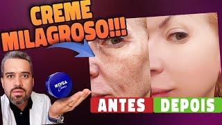 CREME PODEROSO PARA PELE MANCHADA e FALTA DE COLÁGENO