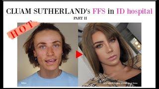 CLUAM SUTHERLAND my plastic surgery in korea experience part 2