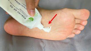 Put some toothpaste on the soles of your feet before going to bed, the effect is amazing,