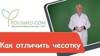 Как отличить чесотку от дерматита, аллергии, псориаза, экземы, лишая, лобкового педикулеза