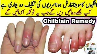 How To Treat Swollen Fingers At Home | Chilblains |Finger Swelling in Winters | By NazKitchen