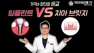 치아브릿지 vs 임플란트. 무얼 해야할지 고민될 때, 이 영상을 보세요. 가격, 수명, 부작용, 장단점까지!