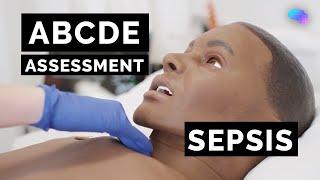 ABCDE Assessment | Sepsis | Emergency Simulation Scenario | OSCE Guide | UKMLA | CPSA | PLAB 2