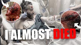 My latest near death experience, What Happened?