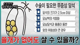 담낭의 돌만 제거할 수 없기에, 담낭(쓸개)를 전부 절제해야하는 담석증. 그렇다면 쓸개가 없어도 살아가는데 지장이 없을까? l KBS 20231018 방송