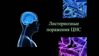 Листериоз: эпидемиология, ключевые клинические формы, диагностика и лечение