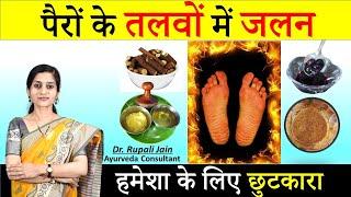 पैरों के तलवों में जलन || Burning Feet Syndrome || सम्पूर्ण आयुर्वेदिक चिकित्सा  Ayurvedic treatment