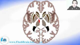 Lessons And 3D Anatomy Software: Horizonta Section Of Brain