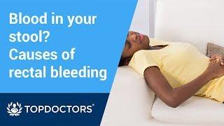 Blood in your stool? the causes and treatments of rectal bleeding