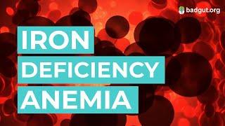 Iron Deficiency Anemia | Animated Video | Gastrointestinal Society