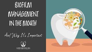 Dental and Oral Biofilm Management and Why Its Important